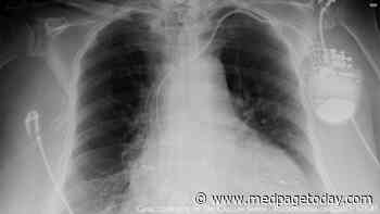 Study: CRT-D Best When RV Pacing Is Needed