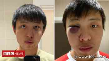 Boy sentenced for London racist coronavirus attack