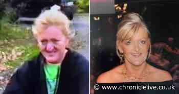 Business owner bullied over 'hooked nose' tells how surgery transformed her life