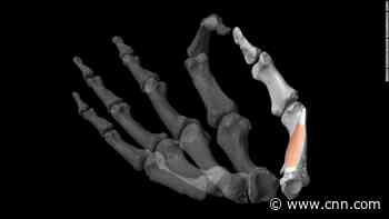 Thumbs gave human ancestors a 'formidable' advantage