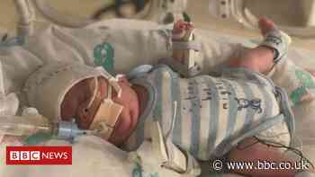 Covid: Baby born at 1lb 11oz survives virus and sepsis