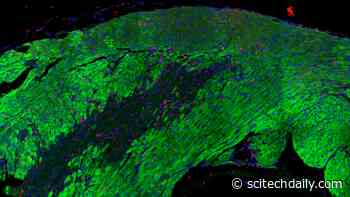 Heart Recovery After Heart Attack Mapped in Great Detail