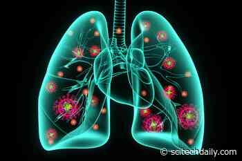 Novel Molecules Discovered to Combat Asthma and COVID-Related Lung Diseases