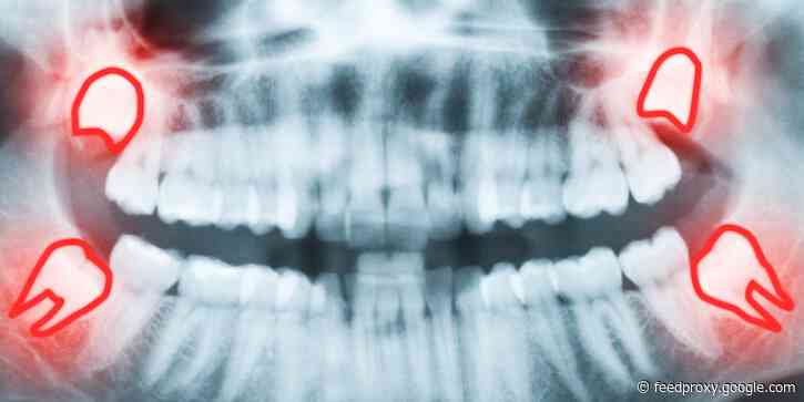 6 ways evolution screwed us over