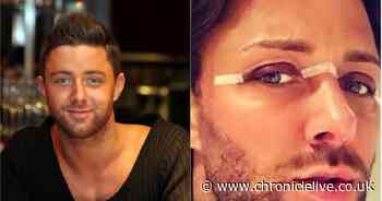Former Geordie Shore star says he's on his 'fifth face' after plastic surgery