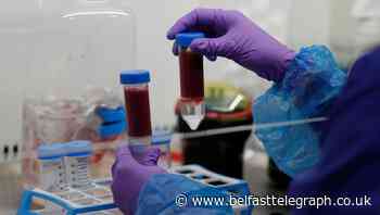 Record 101 deaths due to Covid-19 reported in Ireland