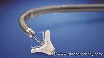 Proportionality Can't Explain Conflicting MitraClip Results