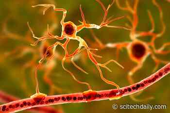 Study Links Brain Cells to Depression – Brings Hope for Targeted Treatment Options