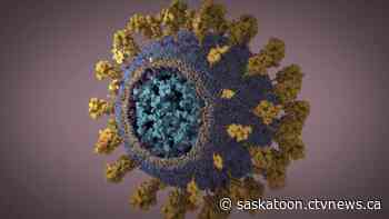 Case of COVID-19 variant confirmed in Saskatoon