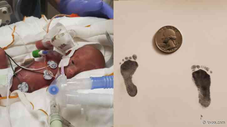 Sierra Vista family asks for help after welcoming one-pound baby to the world
