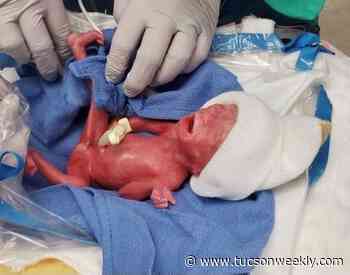 1-Pound Baby Born at Tucson Medical Center