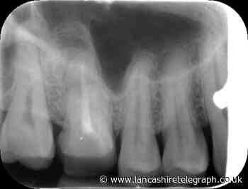 Dental Law Partnership: Lancashire man wins compensation from Burscough dentists