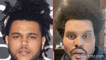 The Weeknd -- Good Genes or Good Docs?!