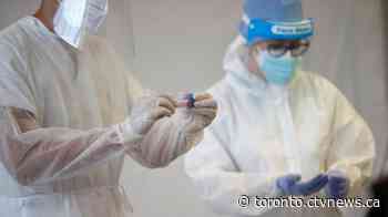 Toronto reports Canada's first known case of COVID-19 variant first seen in Brazil