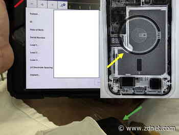 iPhone 12 magnet array can disrupt implantable medical devices