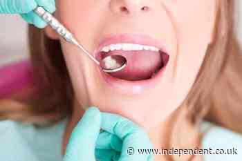 ‘British dentistry, is it?’: A trip to an American dentist shattered my confidence