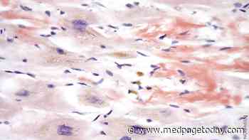 Did Cardiac Amyloidosis  Undermine HFpEF Trials?