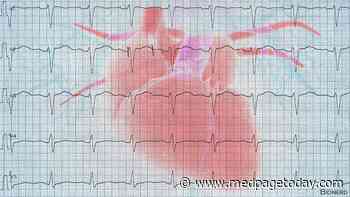 AI Uncovers Occult Long QT Syndrome