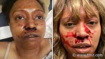 Chad Wheeler Victim Alleah Taylor Reveals Disturbing Injury Pics, Wants NFL Player In Prison
