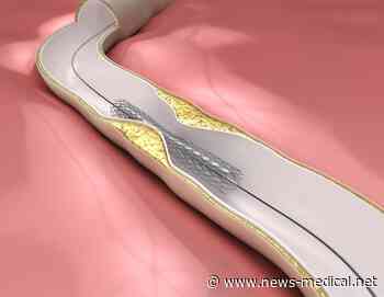 Cell-selective nanotherapy can help treat atherosclerotic plaques