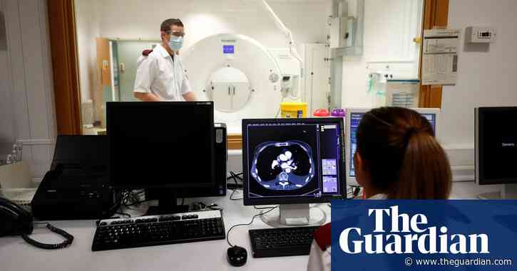 CT scan catches 70% of lung cancers at early stage, NHS study finds