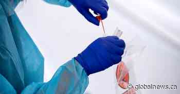 143 new coronavirus infections reported in Saskatchewan