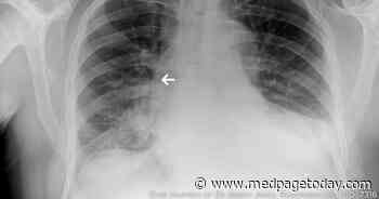 Abandoned Cardiac Device Leads More MRI-Friendly Than Previously Thought