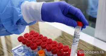 No new deaths in Saskatchewan while total coronavirus cases surpass 27K - Globalnews.ca
