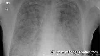 Lung Hemorrhage in Lupus: Which Patients Die?