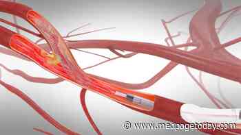 Registry: More Options for Blocked Carotids Mean Better Outcomes