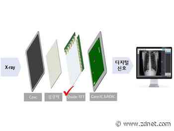 LG Display develops new film transistor for digital X-ray detectors