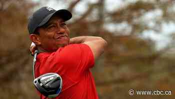 Tiger Woods hospitalized after car crash in California