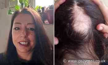 Covid sufferer, 45, blames virus for her dramatic hair loss