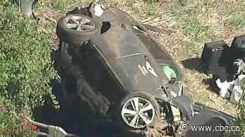 Tiger Woods undergoes surgery for leg injuries suffered in California car crash