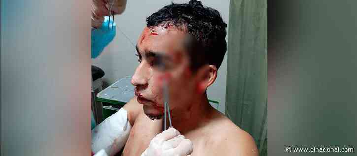 Atacaron a un venezolano en Perú con picos de botella para robarlo