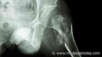 Combo Tx for RA Raises Fracture Risk