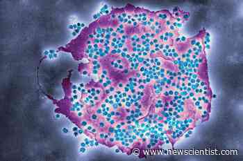 First universal coronavirus vaccine will start human trials this year - New Scientist