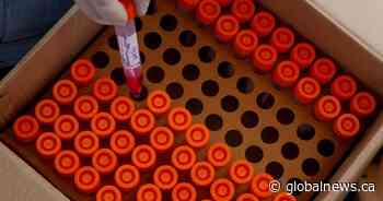 Coronavirus: 3 new deaths, lowest daily infections so far in 2021 in Saskatchewan