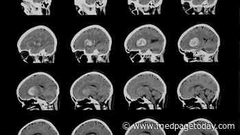 Antioxidants Go After Secondary Injury in Brain Bleeds