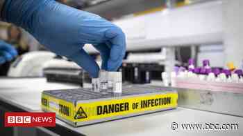 Coronavirus: NI's weekly Covid-related death toll falls again - BBC News