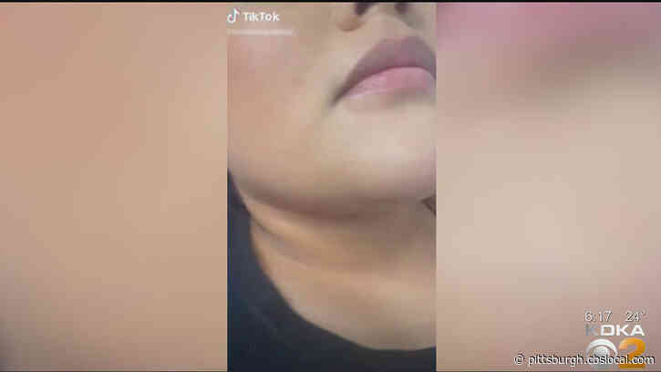 American Dermatological Association Warns Parents Over Dangerous Skincare Trend On TikTok