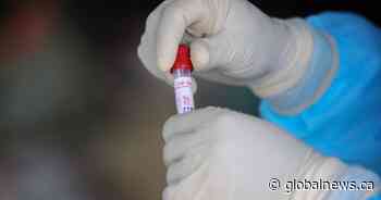 Coronavirus: No new COVID-19 deaths, Saskatchewan lab greenlit to test for variants