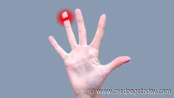 The Case of the Lost Fingertip