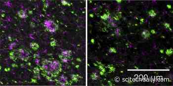 New Drug That Could Prevent Alzheimer’s Disease Found Safe and Effective in Animals