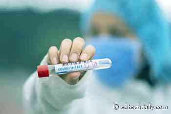 First Test for All Known Human Coronaviruses, Including New COVID-19 Mutations