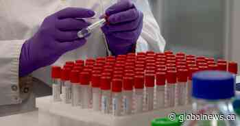 Coronavirus: 2 new deaths as Saskatchewan surpasses 29K total infections - Global News