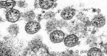 46 more positive tests for coronavirus in Waterloo Region - Globalnews.ca