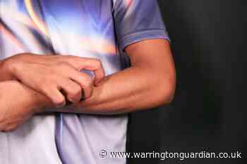 Four Covid-19 skin conditions everyone should know about