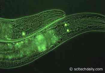 Key Factor Identified That Makes Worms Feel Full – Similar Factor May Control Feelings of Fullness in Humans