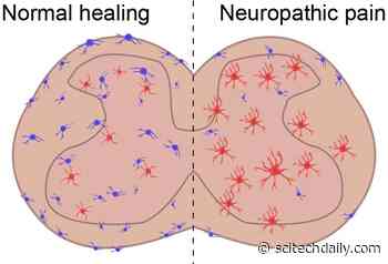 Scientists Find New Cell Type Implicated in Chronic Pain and Inflammation – Precise, New Target for Treatment